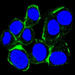 Cell: Neuro-2a. 1/1000.