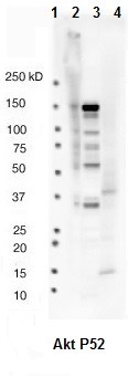 Western blot analysis of: (1) MW markers, (2) HeLa whole cell lysate, (3) HepG2 whole cell lysate (4) Mouse kidney tissue lysate at 1/1000.